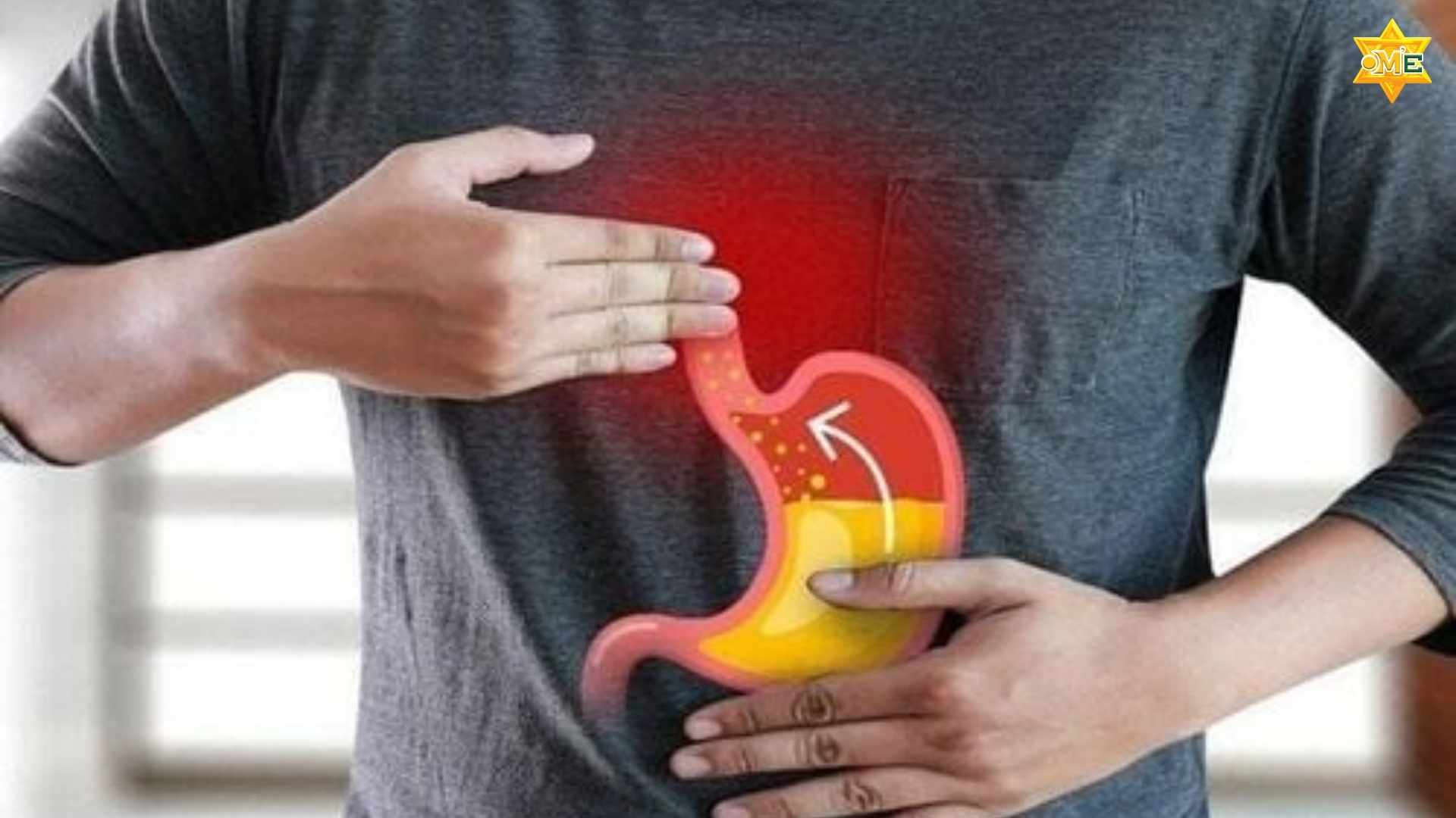 Hướng Dẫn Xoa Bóp Chữa Trào Ngược Dạ Dày