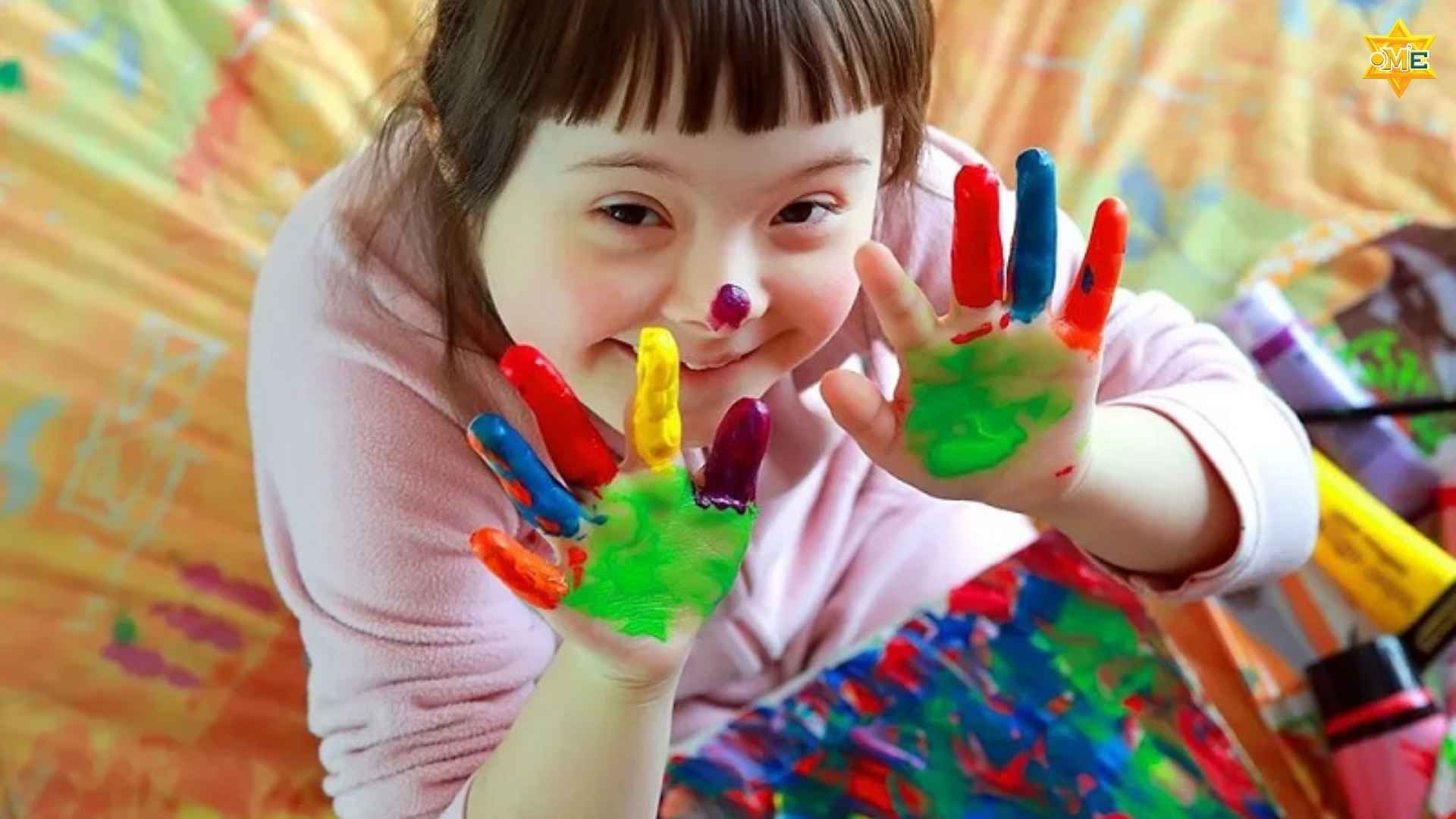 Chậm phát triển trí tuệ ở trẻ em 