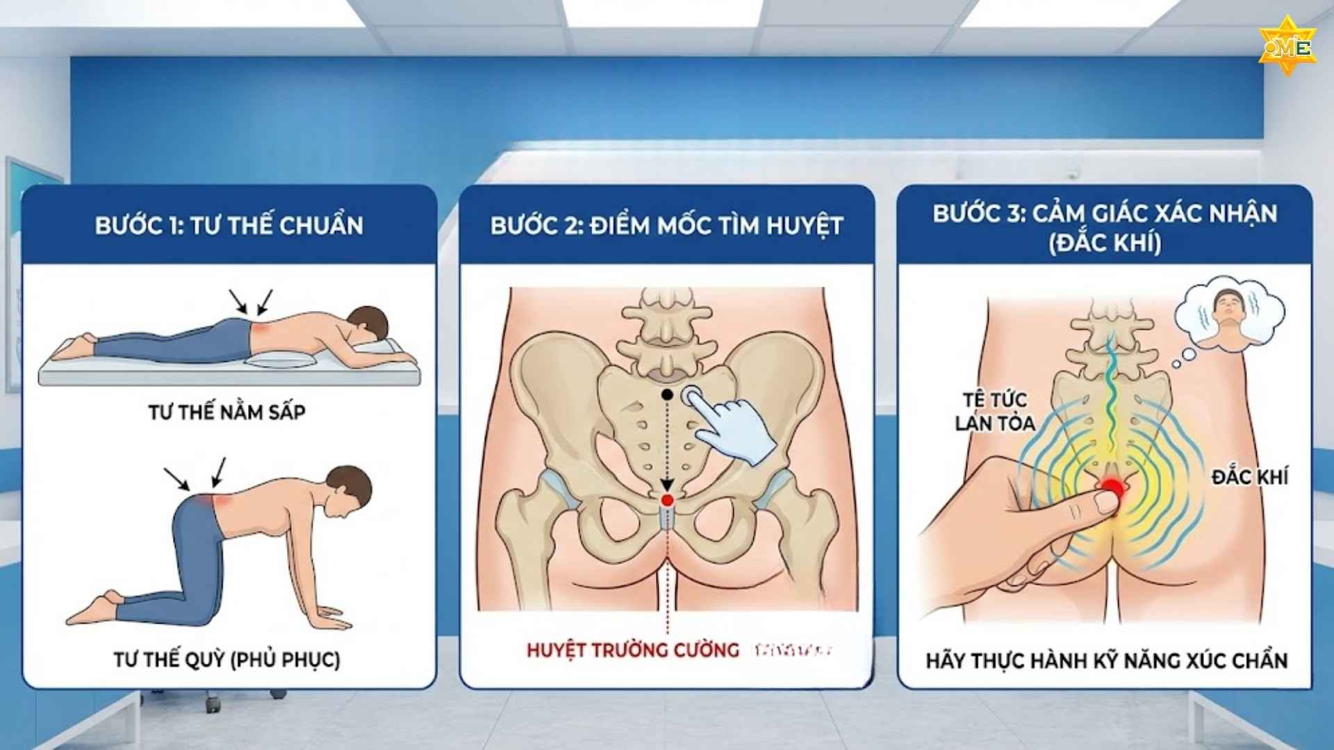 Tìm hiểu vị trí và cách xác định huyệt trường cường