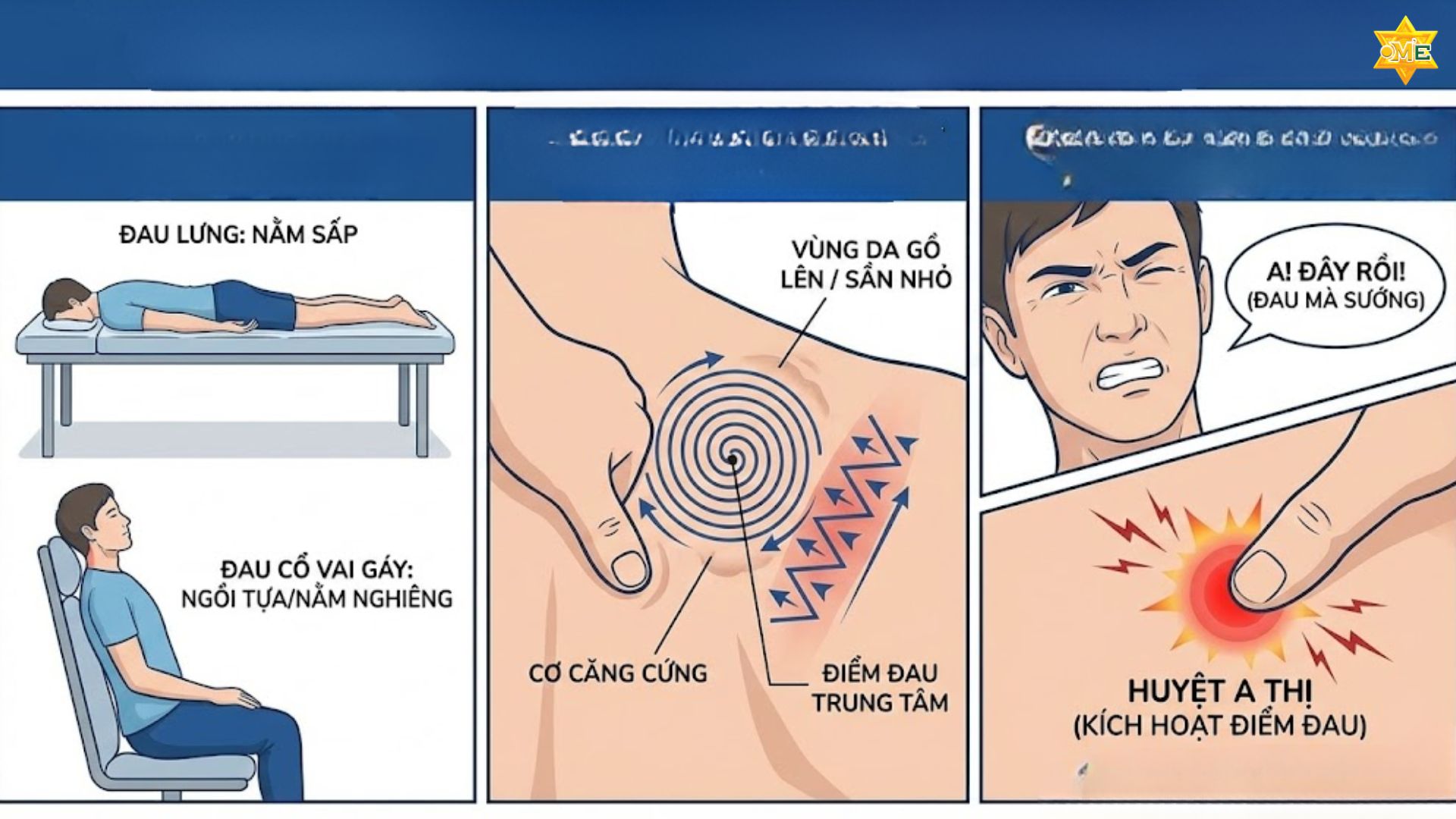 Cách xác định huyệt a thị