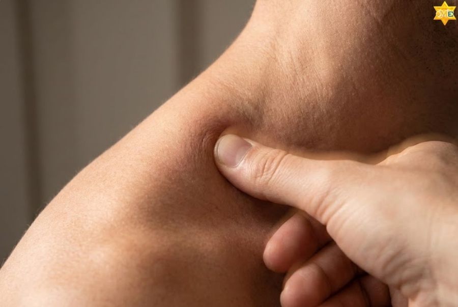 công dụng của huyệt a thị