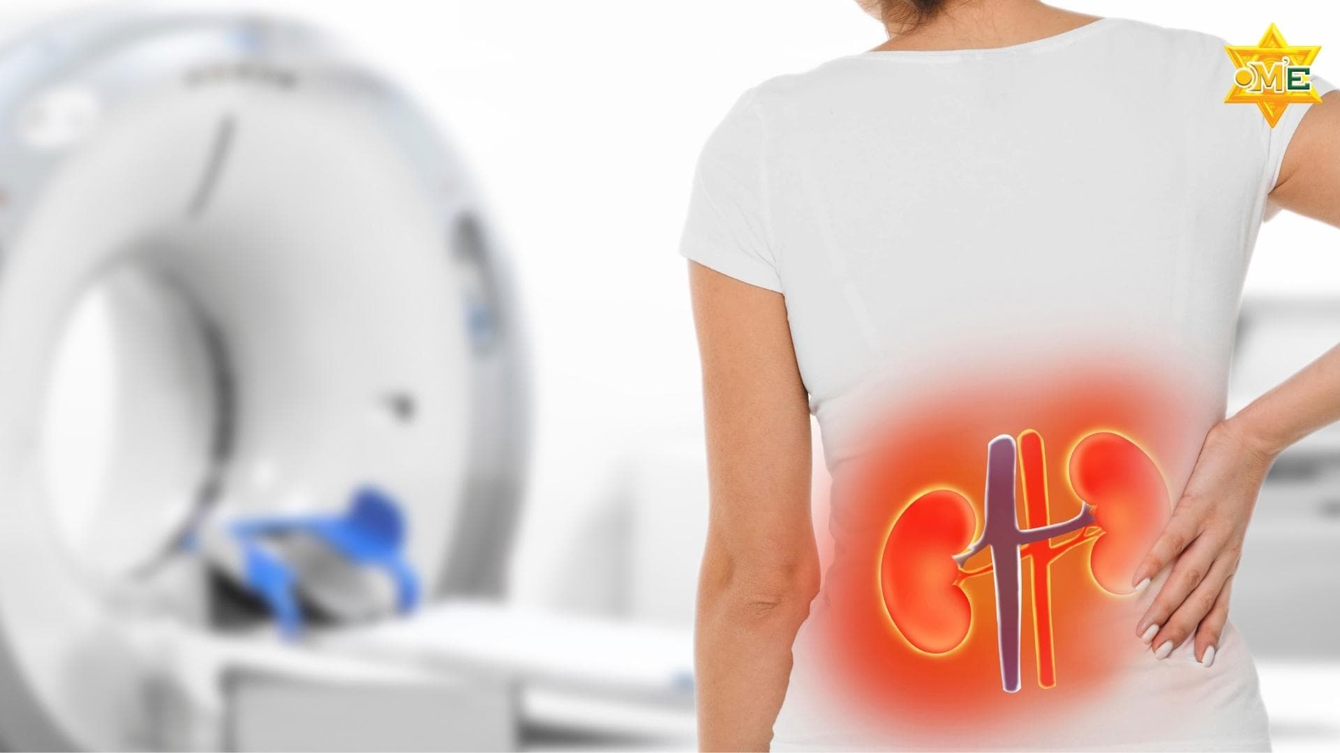 Hội Chứng Thận Hư Là Gì? Chế Độ Dinh Dưỡng Khoa Học Cho Người Mắc Bệnh