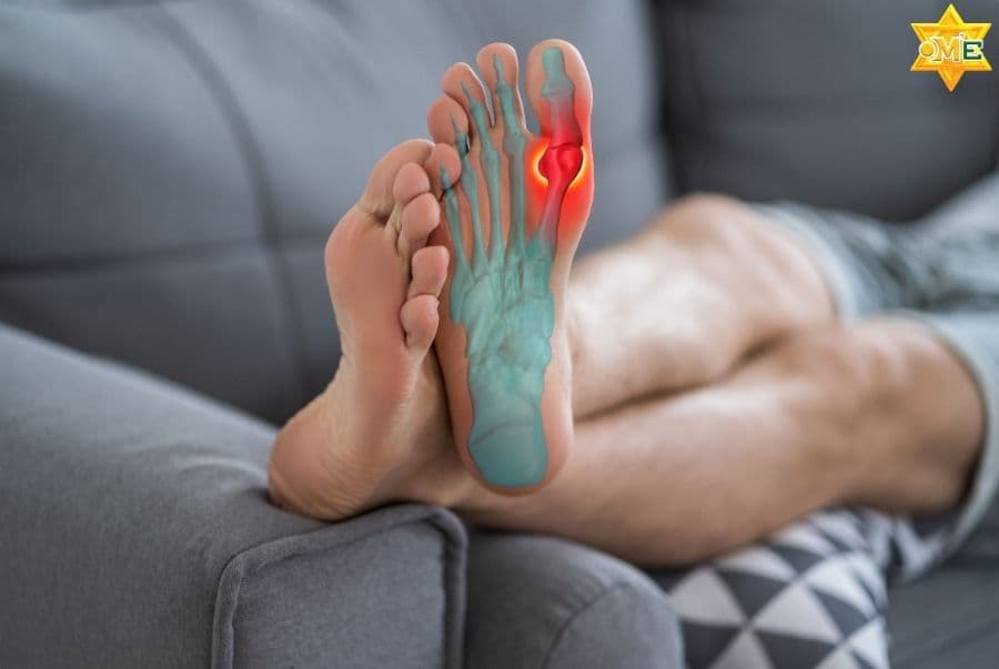 Người mắc bệnh Gút – Quy trình bấm huyệt cải thiện sức khỏe toàn diện, an toàn, hiệu quả